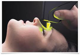Yellow Laser Treatment